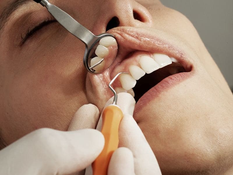 Dentist examining a patient's teeth with a mouth mirror