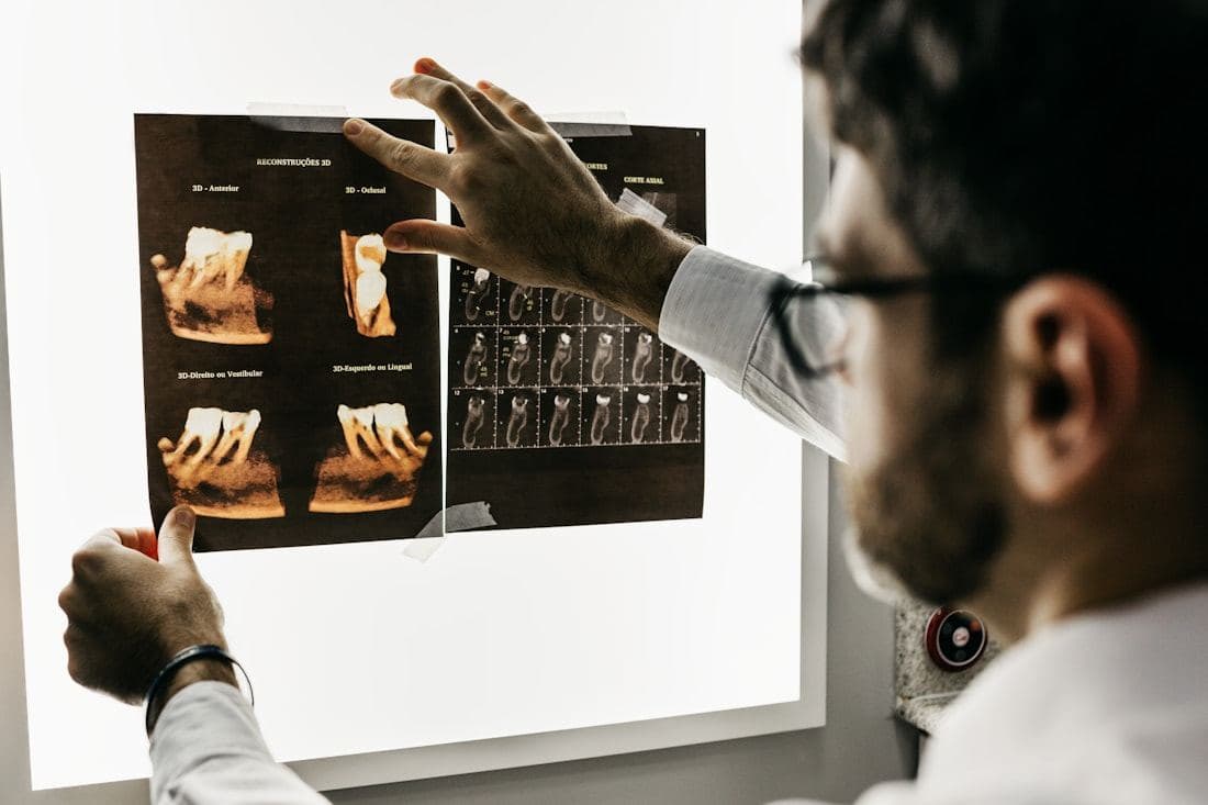 Dentist reviewing dental X-rays on a lightbox